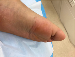 ������Ӱl�F�Լ��_��Ƥ�w���Е��ӵ��x��