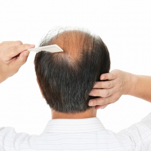 ���Ȱl�H�����m���M���fԪ ֲ�l���g3�켴�ɌW����