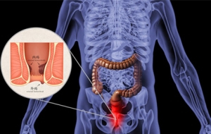 �������\�ģ��vһ�v�̯������ҿ���