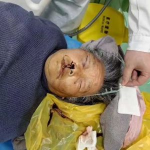 �o�����ˣ�һ���������t(y��)Ժ���ȣ�