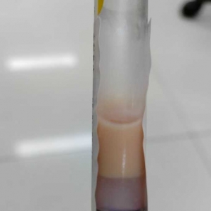 �����w��(n��i)�����ţ��Ѫ�������@Щ��(x��)�T����Ҫע��